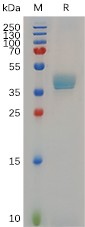 Cynomolgus CCR8 Protein, hFc Tag on SDS-PAGE under reducing condition.